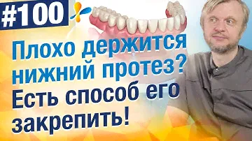 Закрепить нижний зубной протез на имплантах. Цена? Почему это самый удобный способ крепления?